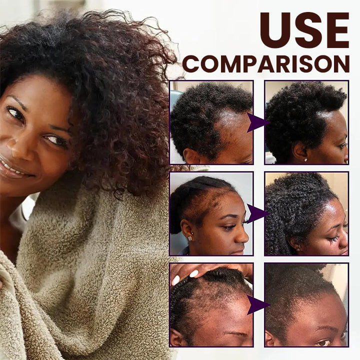 LIMETOW™ Veganic Hair Growth Oil