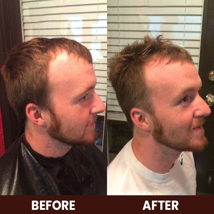 LIMETOW™ Veganic Hair Growth Oil