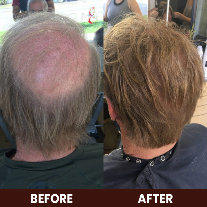 LIMETOW™ Veganic Hair Growth Oil