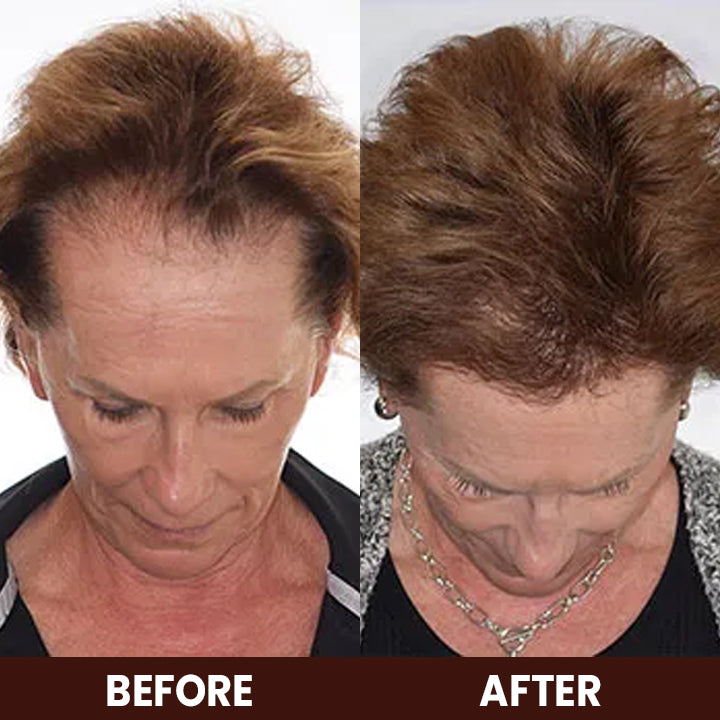 LIMETOW™ Veganic Hair Growth Oil