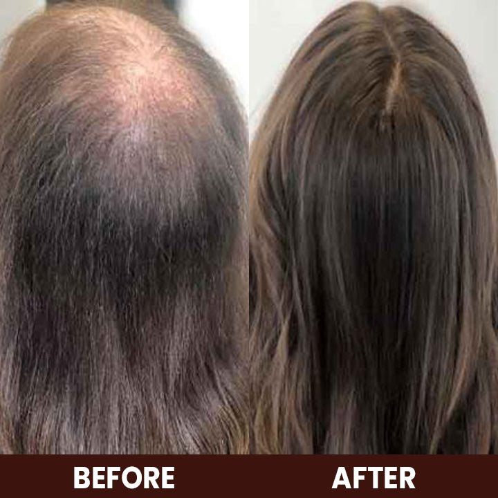 LIMETOW™ Veganic Hair Growth Oil