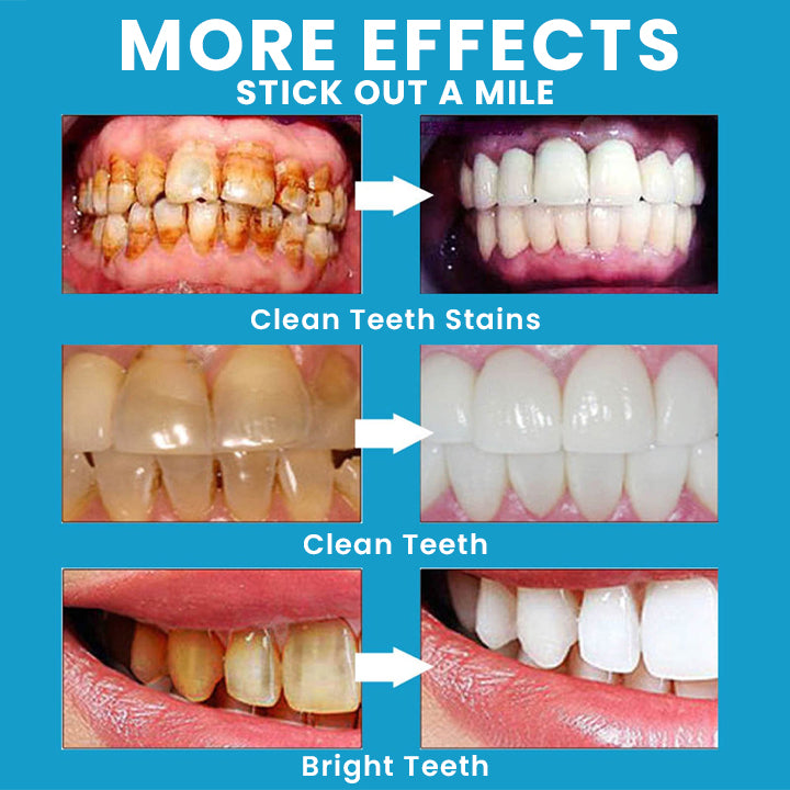 LIMETOW™ Teeth Whitening Essence