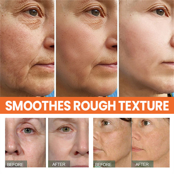 🔥HOT SALE🔥 ✨✨LIMETOW™ Vitamin C Anti-Aging Serum✨✨
