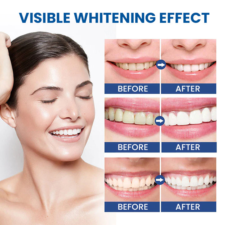LIMETOW™ Teeth Whitening Essence