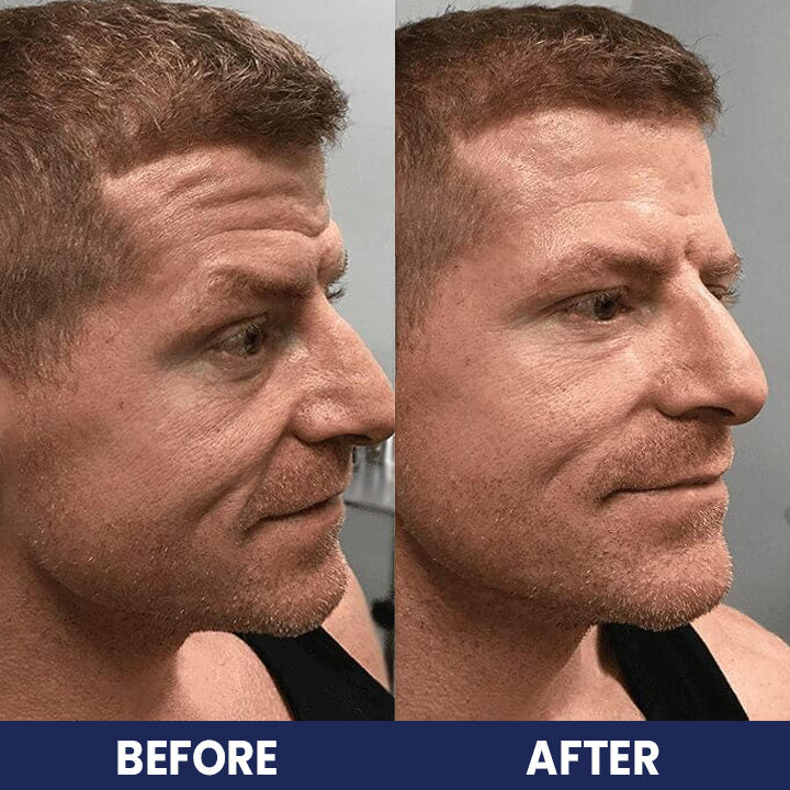 LIMETOW™ Collagen For Men