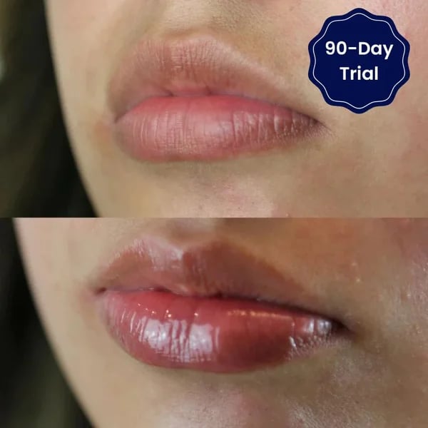 šLIMETOWā¢š„VITAMINELIP SERUM