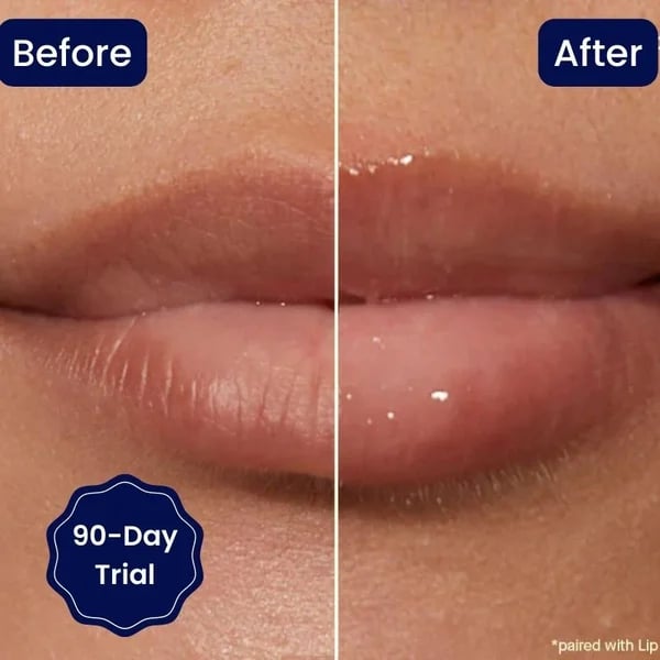 šLIMETOWā¢š„VITAMINELIP SERUM