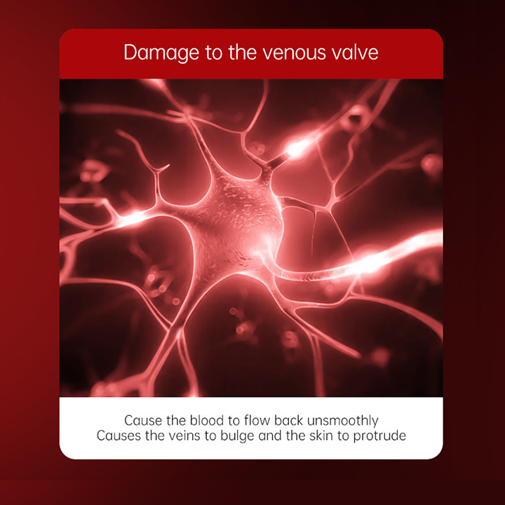 LIMETOW™Varicose Veins Relief Cream
