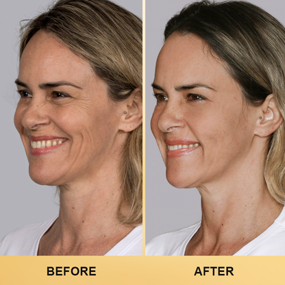 LIMETOW™ Collagen Face Toner