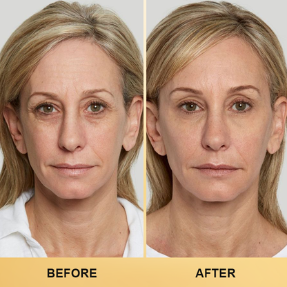 LIMETOW™ Collagen Face Toner