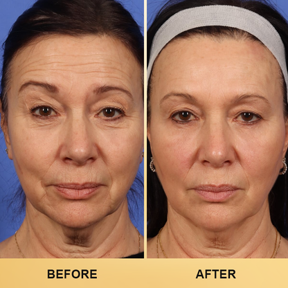 LIMETOW™ Collagen Face Toner