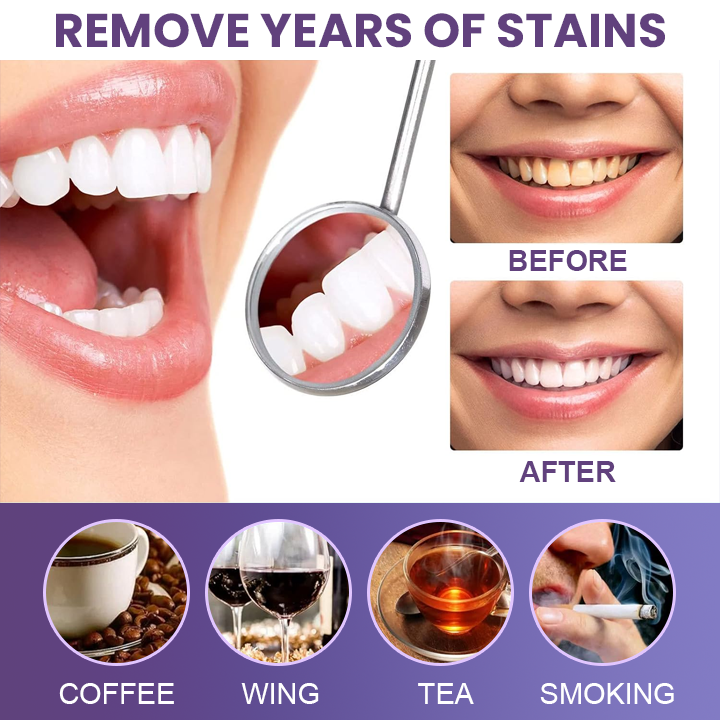 LIMETOW™ Instant Purple Teeth Whitening Paint
