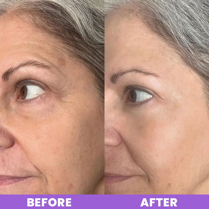 LIMETOW™ Peptide Eye Cream