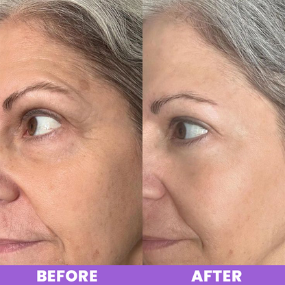 LIMETOW™ Peptide Eye Cream