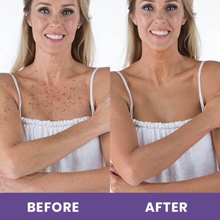 LIMETOW™ Body Coverage Perfector