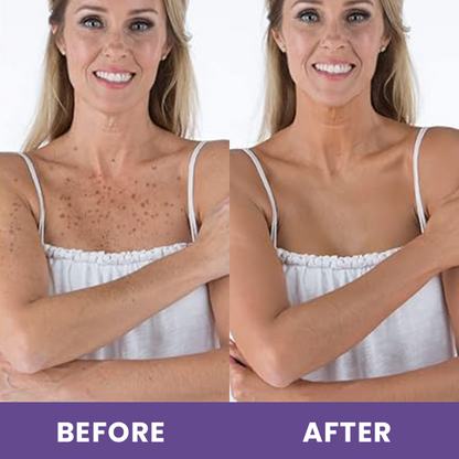 LIMETOW™ Body Coverage Perfector