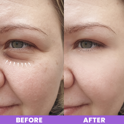 LIMETOW™ Peptide Eye Cream