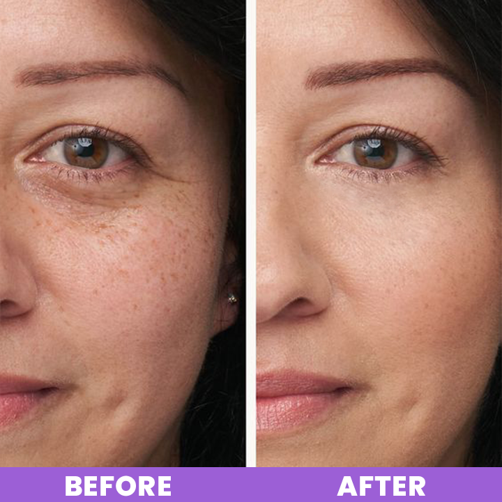 LIMETOW™ Peptide Eye Cream
