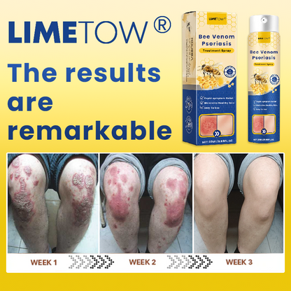 Official Store： LIMETOW® Bee Venom Psoriasis Treatment Spray