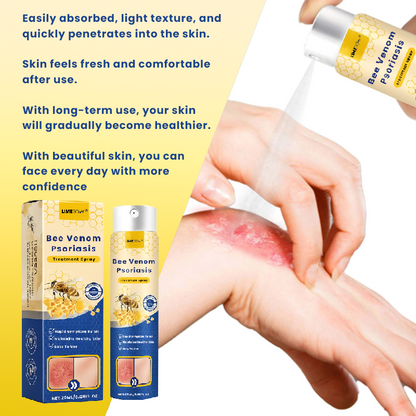 Official Store： LIMETOW® Bee Venom Psoriasis Treatment Spray