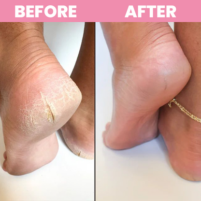 LIMETOW® Shower Foot Scrubber Mat