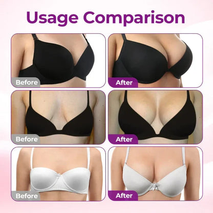 LIMETOW®Breast Enhancement Microneedle Patch