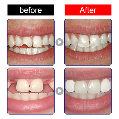 LIMETOW™ Promotional Thermoformable Moldable Teether