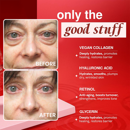 LIMETOW® Retinol Eye Stick✅ for Reduces Fine Lines，Puffiness and Dark Circles🌟