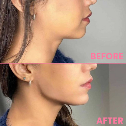 LIMETOW™ Face Lifting Suction Trainer
