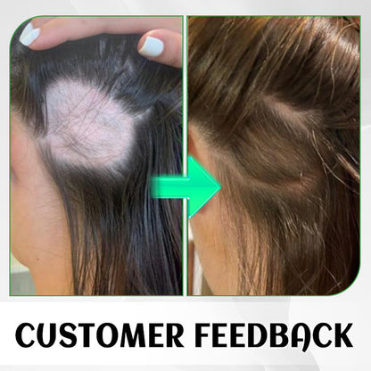 LIMETOW™ FolliHerb Hair Growth Spray
