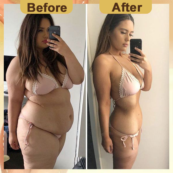 🎉2024 New Abdominal Detox Ginger Oil🎉（Limited Time Discount 🔥 Last Day）