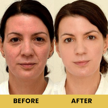 LIMETOW™ Advanced Snail 96 Mucin Power Essence