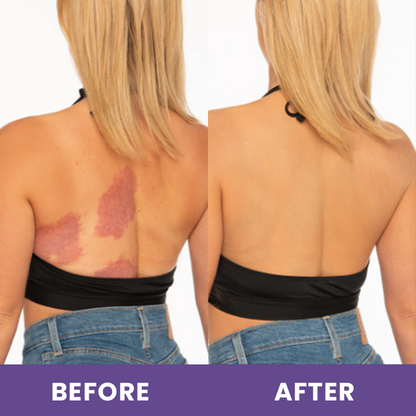 LIMETOW™ Body Coverage Perfector