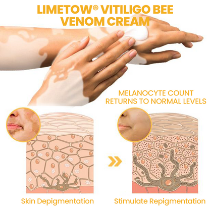 LIMETOW® Vitiligo Bee Venom Cream