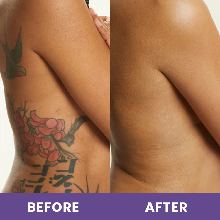 LIMETOW™ Body Coverage Perfector