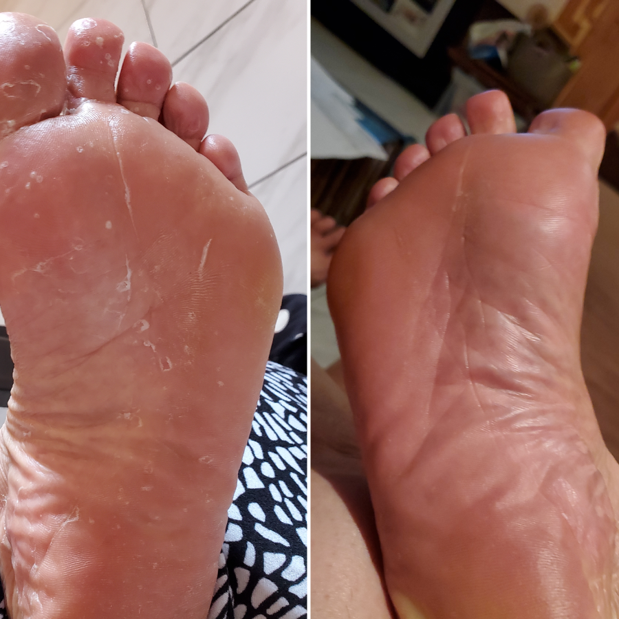 LIMETOW®Antifungal Soap