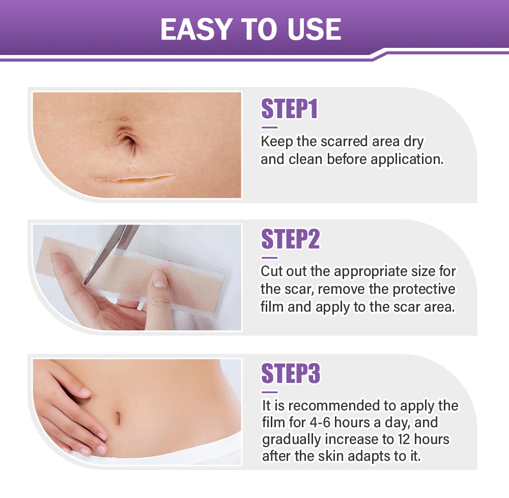 LIMETOW® Ceramide Silicone Scar Gel Tape