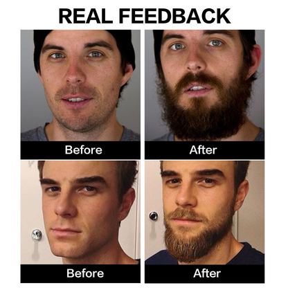 LIMETOW™ Beard Growth Organic Care Oil