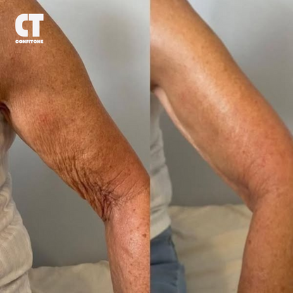 7 Shocking Reasons Your Arms Won't Tone After 50 (Even With Exercise)