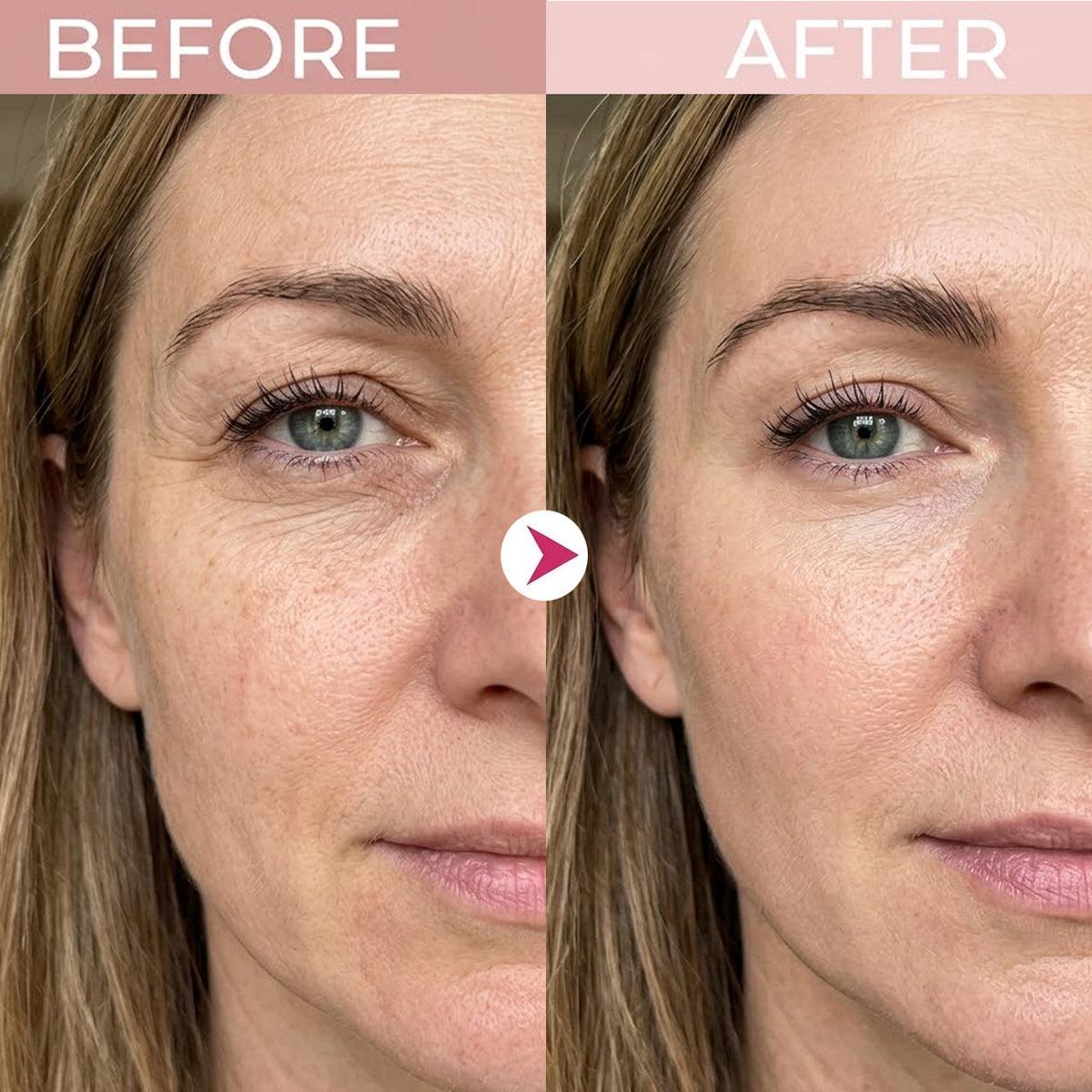 LIMETOW® P7Eye Renewal Crème