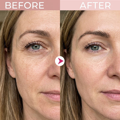LIMETOW® P7Eye Renewal Crème