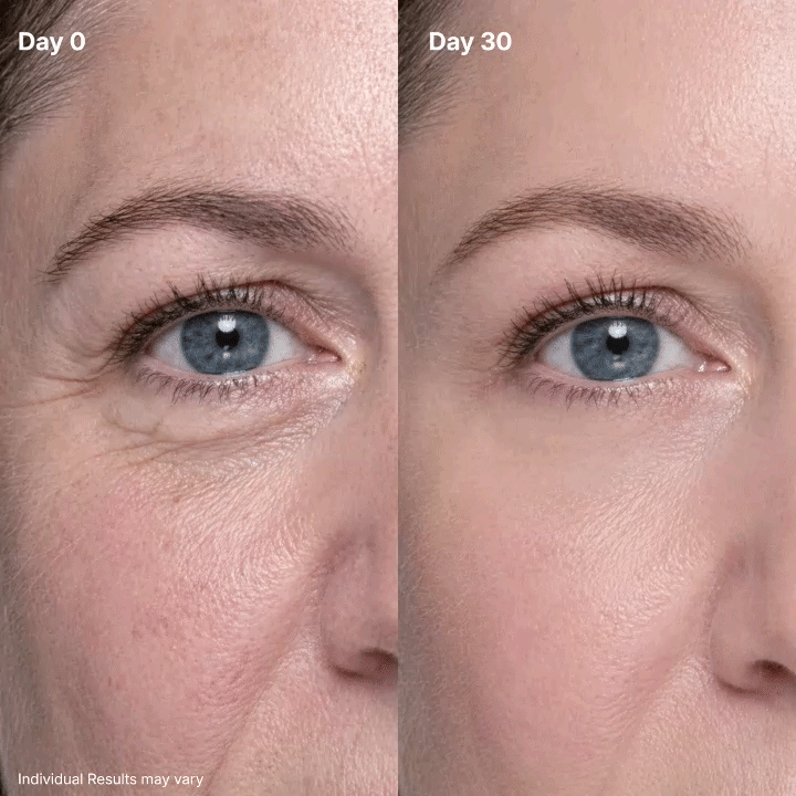 LIMETOW® P7Eye Renewal Crème