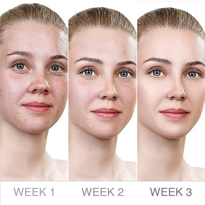 LIMETOW™ Truffle Biome Skin Cream
