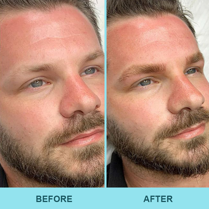 ✨Last Day Discount：80% OFF🔥 LIMETOW™ Eyebrow Essence