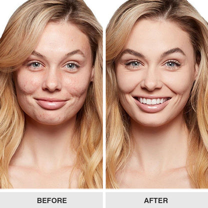 LIMETOW™ Truffle Biome Skin Cream