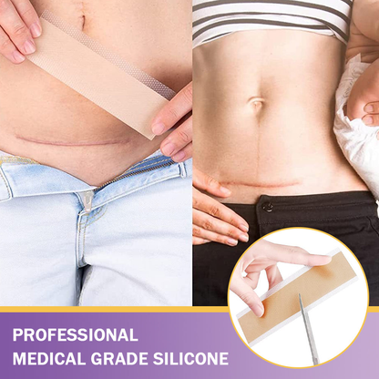 LIMETOW® Ceramide Silicone Scar Gel Tape