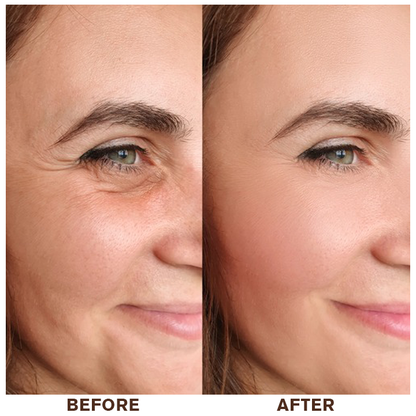 LIMETOW™ Instant Eye Cream Tightener