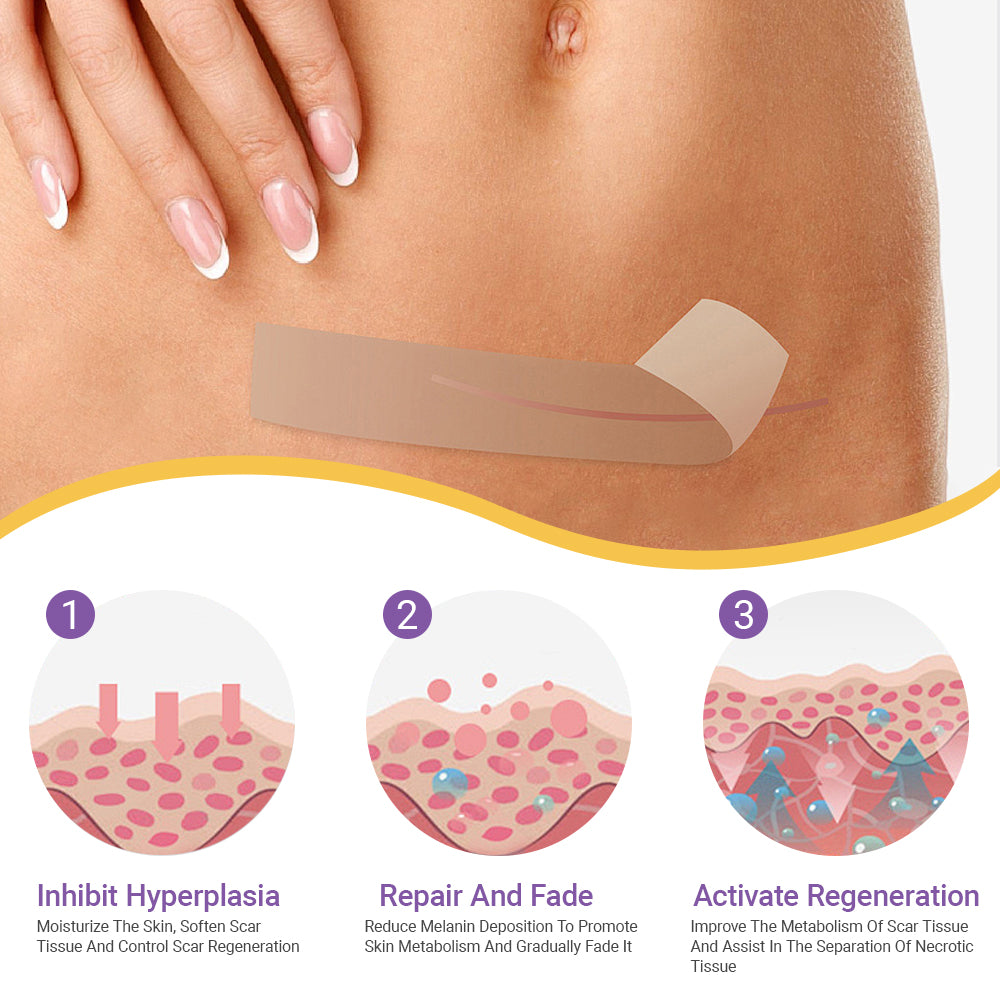 LIMETOW® Ceramide Silicone Scar Gel Tape
