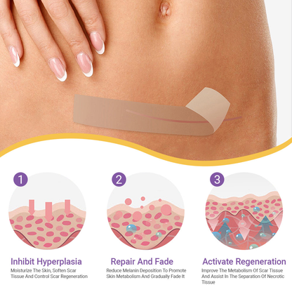 LIMETOW® Ceramide Silicone Scar Gel Tape