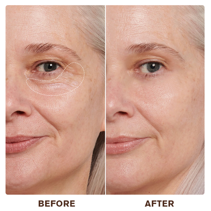 LIMETOW™ Instant Eye Cream Tightener